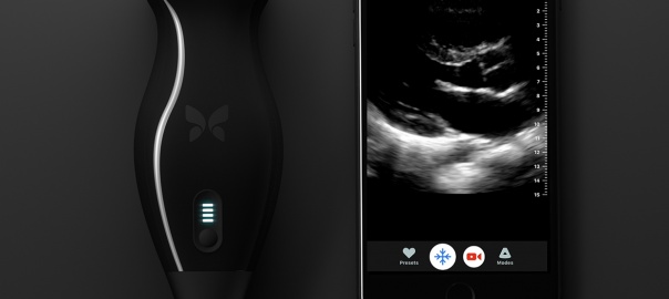 Butterfly IQ – Ultrasound Anywhere, Anytime